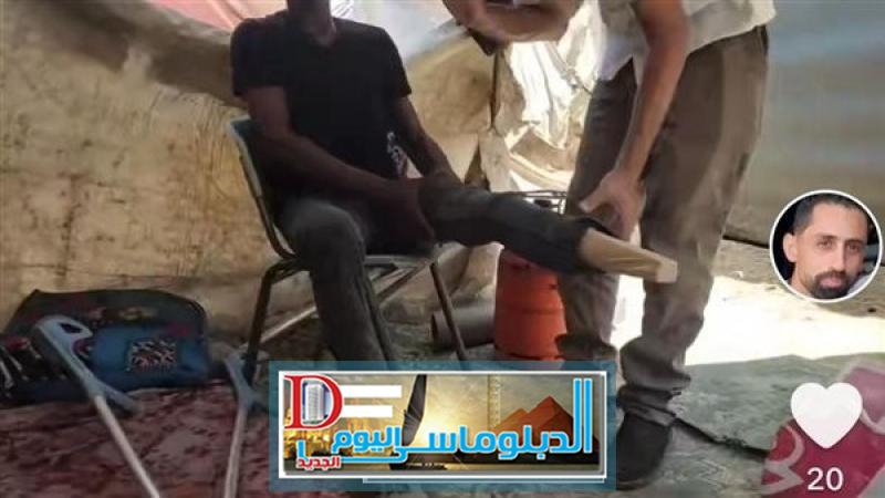 صناعة الأطراف الصناعية في غزة 